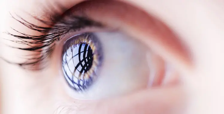 Glaucoma - Imagem 1