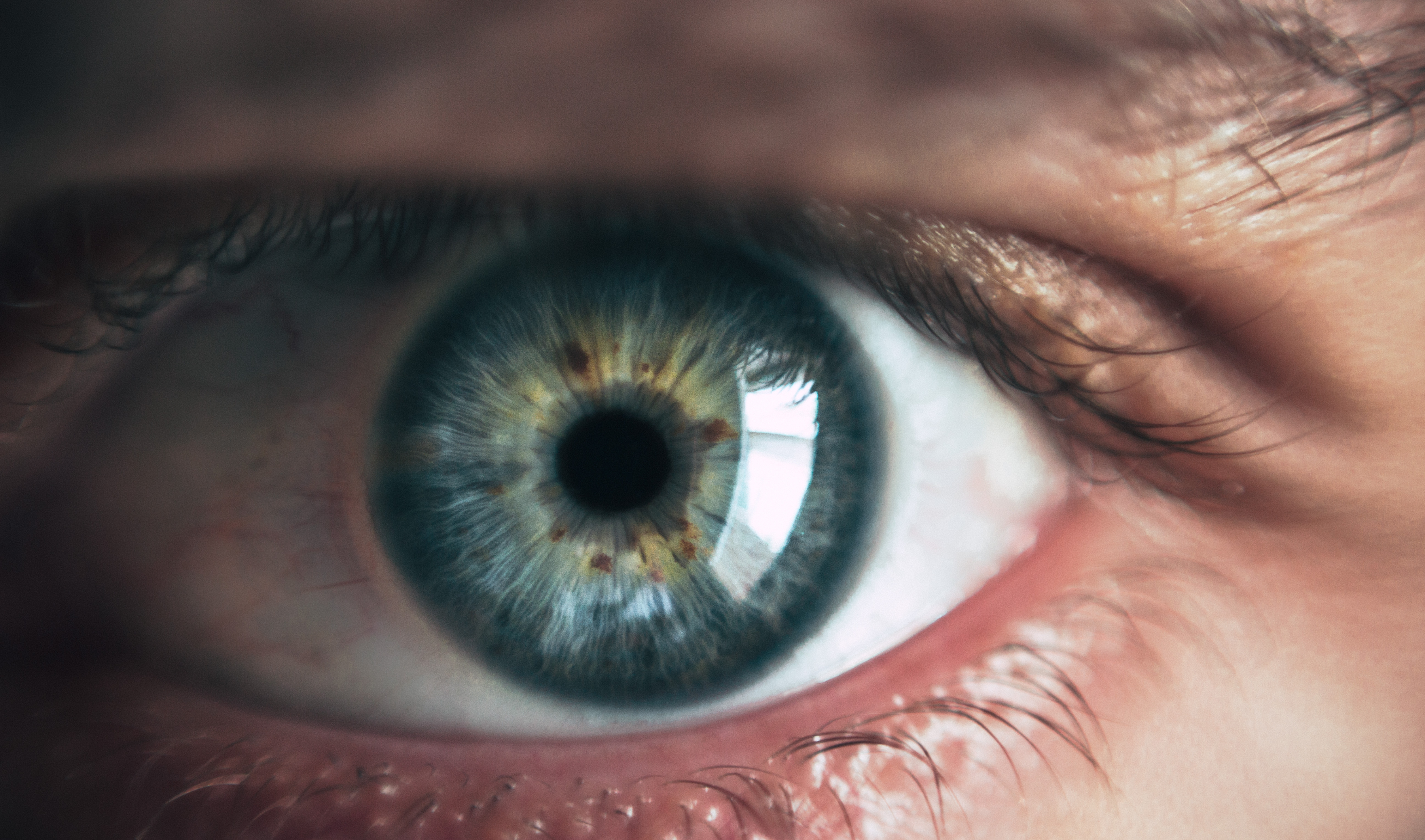 Retina - Imagem 1