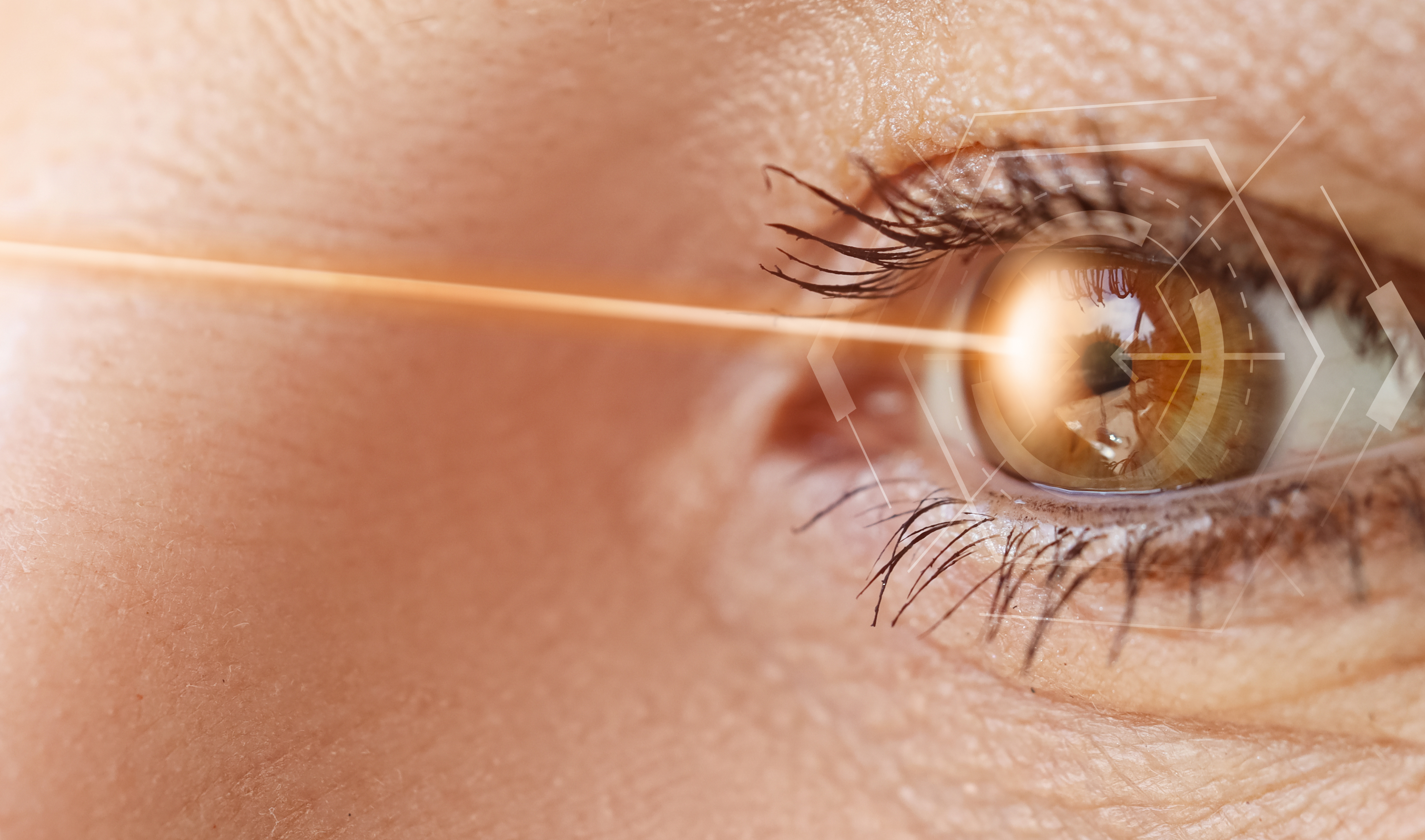 Retina - Imagem 3